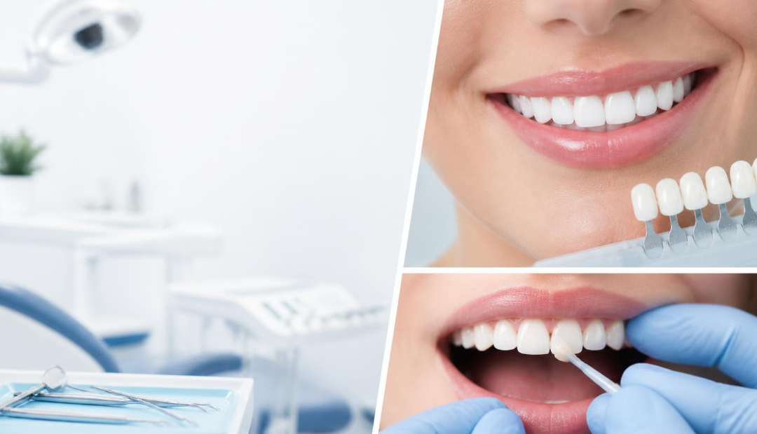 Porcelain Veneers vs. Dental Bonding: Clinical Differences, Longevity, and Cost Analysis