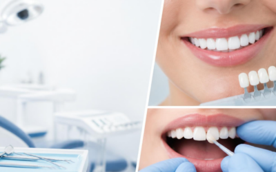 Porcelain Veneers vs. Dental Bonding: Clinical Differences, Longevity, and Cost Analysis